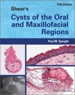 Shear’s Cysts of the Oral and Maxillofacial Regions 5th Edition