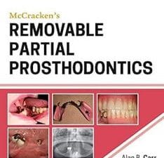 McCracken’s Removable Partial Prosthodontics 13th Edition