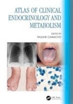 Atlas of Clinical Endocrinology and Metabolism 1st Edition