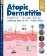 Atopic Dermatitis: Inside Out or Outside In 1st Edition