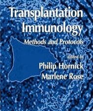 transplantation immunology: methods and protocols (methods in molecular biology, 333) 2006th edition