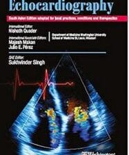 The Washington Manual of Echocardiography (SAE) – 1E