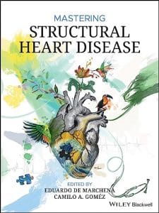 Mastering Structural Heart Disease 1st Edition