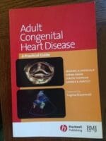 Adult Congenital Heart Disease: A Practical Guide 1st Edition
