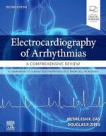 Electrocardiography of Arrhythmias: A Comprehensive Review: A Companion to Cardiac Electrophysiology 2nd Edition