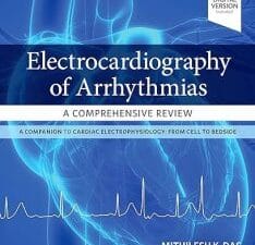 Electrocardiography of Arrhythmias: A Comprehensive Review: A Companion to Cardiac Electrophysiology 2nd Edition