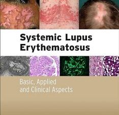 systemic lupus erythematosus: basic, applied and clinical aspects 1st edition