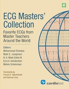 ECG Masters Collection: Favorite ECGs from Around the World 1st Edition