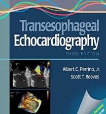 A Practical Approach to Transesophageal Echocardiography