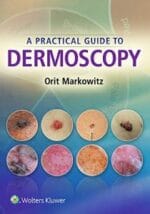 A Practical Guide to Dermoscopy