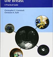 abbreviated mri of the breast (a practical guide) 1st edition