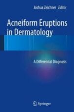 Acneiform Eruptions in Dermatology: A Differential Diagnosis