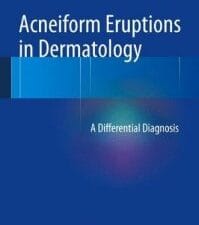 Acneiform Eruptions in Dermatology: A Differential Diagnosis