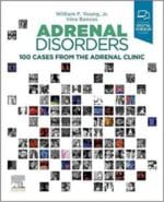 Adrenal Disorders: 100 Cases from the Adrenal Clinic 1st Edition