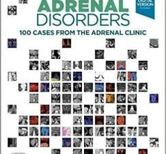 Adrenal Disorders: 100 Cases from the Adrenal Clinic 1st Edition
