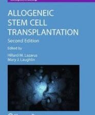 allogeneic stem cell transplantation