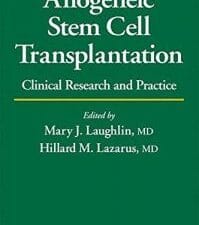 allogeneic stem cell transplantation (1st edition)