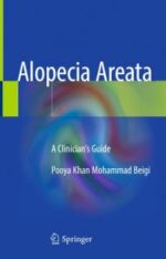 alopecia areata: a clinician’s guide