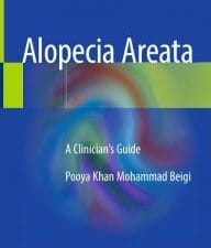 alopecia areata: a clinician’s guide