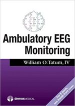 ambulatory eeg monitoring 1st edition
