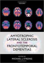 amyotrophic lateral sclerosis and the frontotemporal dementias