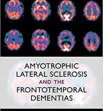 amyotrophic lateral sclerosis and the frontotemporal dementias