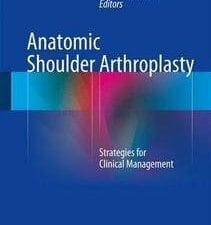 Anatomic Shoulder Arthroplasty: Strategies for Clinical Management