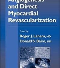 Angiogenesis and Direct Myocardial Revascularization