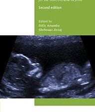 antenatal disorders for the mrcog and beyond