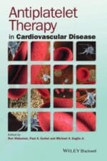 Antiplatelet Therapy in Cardiovascular Disease