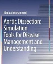aortic dissection: simulation tools for disease management and understanding