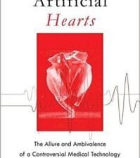 Artificial Hearts: The Allure and Ambivalence of a Controversial Medical Technology