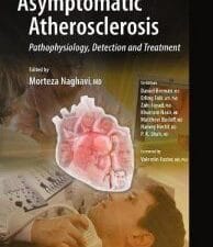 Asymptomatic Atherosclerosis: Pathophysiology, Detection and Treatment