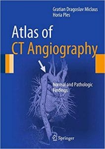 Atlas of CT Angiography: Normal and Pathologic Findings