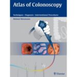 atlas of colonoscopy: examination techniques and diagnosis