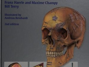 atlas of craniomaxillofacial osteosynthesis: microplates, miniplates, and screws 2nd edition