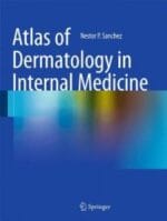 Atlas of Dermatology in Internal Medicine