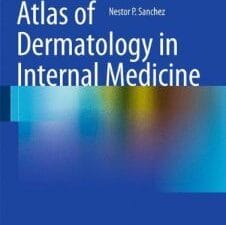 Atlas of Dermatology in Internal Medicine