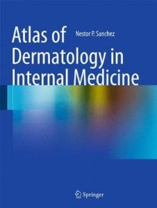 Atlas of Dermatology in Internal Medicine