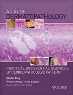 Atlas of Dermatopathology: Practical Differential Diagnosis by Clinicopathologic Pattern 1st Edition, Kindle Edition