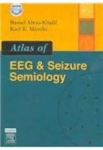 atlas of eeg & seizure semiology: text with dvd 1st edition