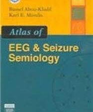 atlas of eeg & seizure semiology: text with dvd 1st edition