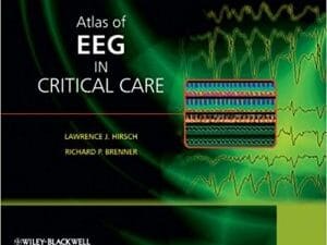 Atlas of EEG in Critical Care 1st Edition