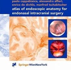 Atlas of Endoscopic Anatomy for Endonasal Intracranial Surgery