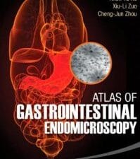 Atlas of Gastrointestinal Endomicroscopy
