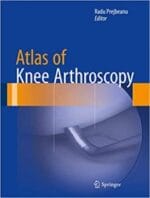 atlas of knee arthroscopy