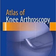 atlas of knee arthroscopy