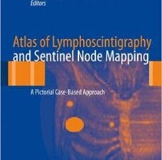 atlas of lymphoscintigraphy and sentinel node mapping: a pictorial case based approach