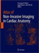 Atlas of Non-Invasive Imaging in Cardiac Anatomy
