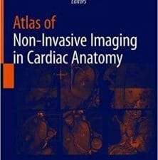 Atlas of Non-Invasive Imaging in Cardiac Anatomy